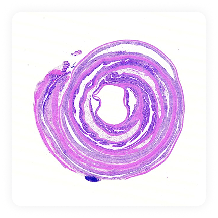DSS-Induced Colitis 모델 설명 이미지 1