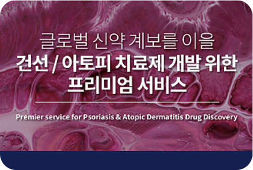건선/아토피 치료제 개발을 인사이트 이미지